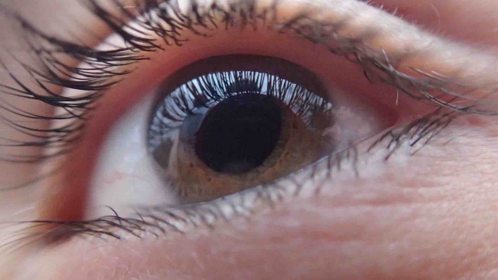 Close-up photo of a person's eye lens